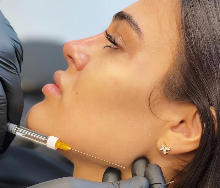 Chin and jawline filler treatment