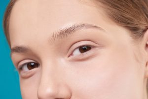 Anti-wrinkle injections