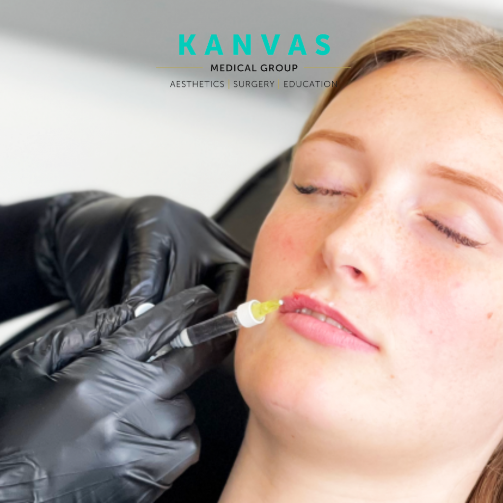 lip filler