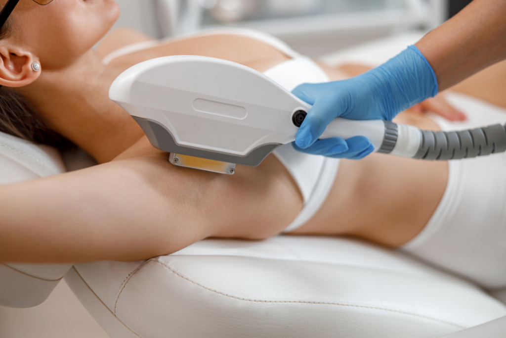 laser hair removal