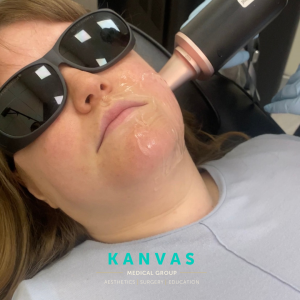 laser hair removal photo