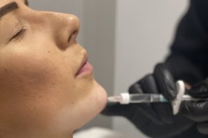 Chin Masterclass