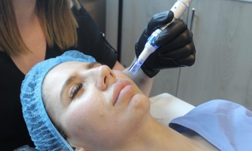 Microneedling training course