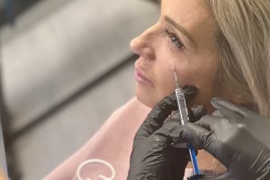 Tear trough training course (1)